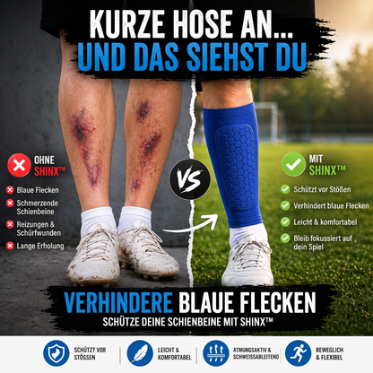 ShinX™ Performance – Verhindert Schmerzhafte Schienbeine Beim Sport